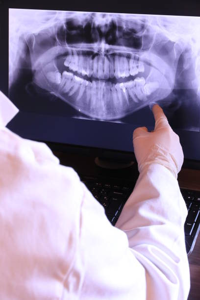 Best Knocked-Out Tooth Emergency  in Hercules, CA