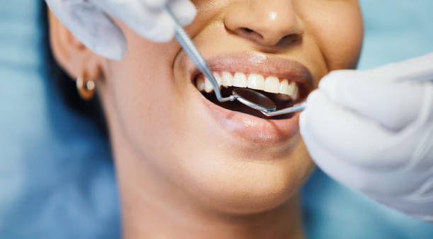 Best Emergency Gum Pain Relief  in Hercules, CA