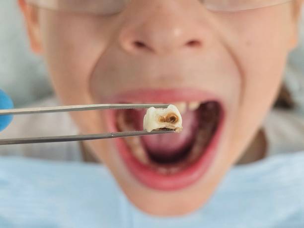 Best Teeth Whitening  in Hercules, CA